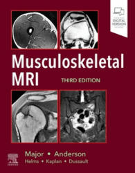 Musculoskeletal MRI (ISBN: 9780323415606)
