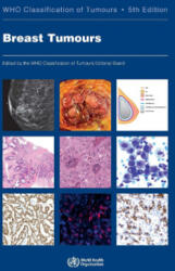 Breast Tumours: Who Classification of Tumours - Who Classification of Tumours Editorial (ISBN: 9789283245001)