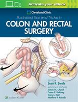 Cleveland Clinic Illustrated Tips and Tricks in Colon and Rectal Surgery (ISBN: 9781975108250)