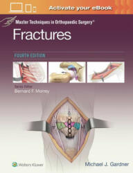 Master Techniques in Orthopaedic Surgery: Fractures - Michael Gardner (ISBN: 9781975139407)