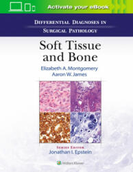 Differential Diagnoses in Surgical Pathology: Soft Tissue and Bone - Elizabeth A. Montgomery, Aaron James (ISBN: 9781975136024)