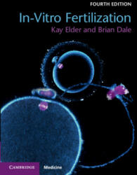 In-Vitro Fertilization - Kay Elder, Brian Dale (ISBN: 9781108441810)