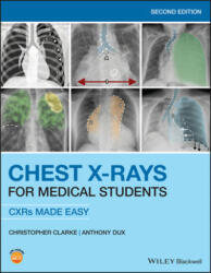 Chest X-Rays for Medical Students - Anthony Dux (ISBN: 9781119504153)