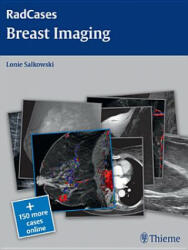 Radcases Breast Imaging - Lonie Salkowski (ISBN: 9781604061918)