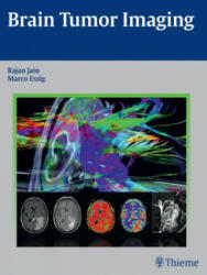 Brain Tumor Imaging - Rajan Jain, Marco Essig (ISBN: 9781604068061)