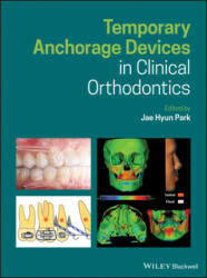 Temporary Anchorage Devices in Clinical Orthodontics - Jae Hyun Park (ISBN: 9781119513476)