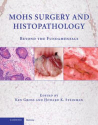 Mohs Surgery and Histopathology - Ken Gross (ISBN: 9780521888042)