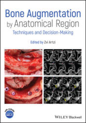 Bone Augmentation by Anatomical Region - Techniques and Decision-Making - Z Artzi (ISBN: 9781119427841)