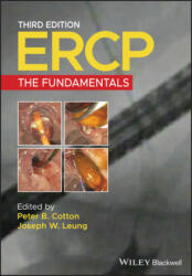 Ercp: The Fundamentals (ISBN: 9781119601098)