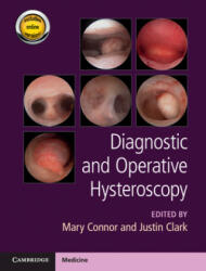 Diagnostic and Operative Hysteroscopy - Justin Clark, Stephen Burrell (ISBN: 9781107111608)