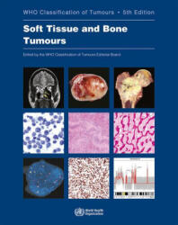 WHO classification of tumours of soft tissue and bone tumours - WHO Classification of Tumours Editorial Board (ISBN: 9789283245025)