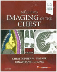 Muller's Imaging of the Chest - Christopher Walker (ISBN: 9780323462259)