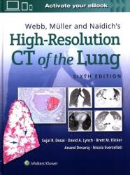 Webb, Muller and Naidich's High-Resolution CT of the Lung (ISBN: 9781975144432)