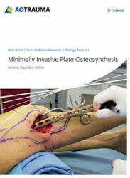 Minimally Invasive Plate Ostheosynthesis - Reto Babst (2012)