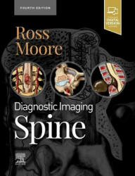 Diagnostic Imaging: Spine (ISBN: 9780323793995)