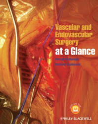 Vascular and Endovascular Surgery at a Glance - Morgan McMonagle, Matthew Stephenson (ISBN: 9781118496039)