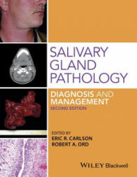 Salivary Gland Pathology - Eric Carlson, Robert A. Ord (ISBN: 9781118933756)