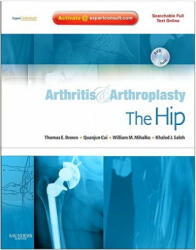 Arthritis and Arthroplasty: The Hip - Thomas Brown (ISBN: 9781416049739)