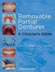 Removable Partial Dentures - John D. Jones, Lily T. Garcia (ISBN: 9780813817064)