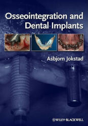 Osseointegration and Dental Implants - Asbjorn Jokstad (ISBN: 9780813813417)