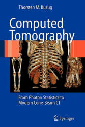 Computed Tomography - Thorsten M. Buzug (2010)