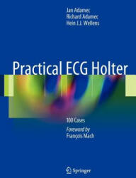 Practical ECG Holter (2011)