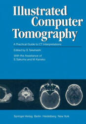 Illustrated Computer Tomography - M. Kaneko, S. Sakuma, S. Takahashi (2012)