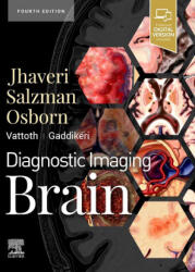 Diagnostic Imaging: Brain - Miral D. Jhaveri (ISBN: 9780323756204)