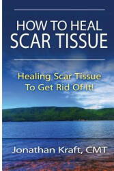 How to Heal Scar Tissue: How to Heal Your Own Scar Tissue And Get Rid Of It! - Jonathan a Kraft (ISBN: 9781481016711)