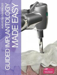 Guided Implantology Made Easy - August De Oliveira (ISBN: 9781105705687)