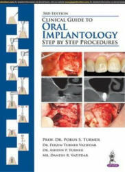 Clinical Guide to Oral Implantology - Porus S Turner, Ferzin Turner Vazifdar, Ashdin P Turner, Danesh R Vazifdar (ISBN: 9789352704279)