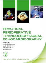 Practical Perioperative Transoesophageal Echocardiography - David Sidebotham (ISBN: 9780198759089)