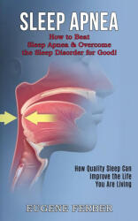 Sleep Apnea: How Quality Sleep Can Improve the Life You Are Living (ISBN: 9781990268366)
