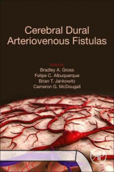 Cerebral Dural Arteriovenous Fistulas - Felipe C. Albuquerque, Brian T. Jankowitz (ISBN: 9780128195253)