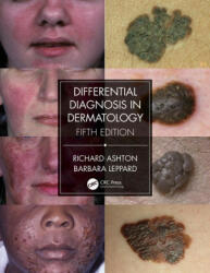 Differential Diagnosis in Dermatology (ISBN: 9780367085971)