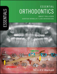 Essential Orthodontics - Birgit Thilander, Krister Bjerklin, Lars Bondemark (ISBN: 9781119165675)