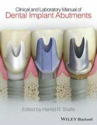 Clinical and Laboratory Manual of Dental Implant Abutments - Hamid R. Shafie (ISBN: 9781119949817)