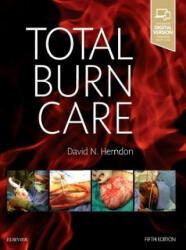 Total Burn Care - Herndon (ISBN: 9780323476614)