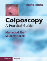 Colposcopy - Mahmood Shafi (ISBN: 9781107667822)