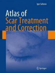 Atlas of Scar Treatment and Correction - Safonov (ISBN: 9783642291951)