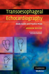 Transoesophageal Echocardiography - Andrew Roscoe (ISBN: 9780521689601)