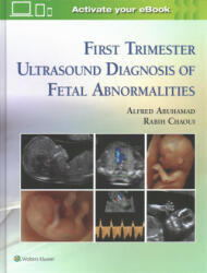 First Trimester Ultrasound Diagnosis of Fetal Abnormalities (ISBN: 9781451193725)