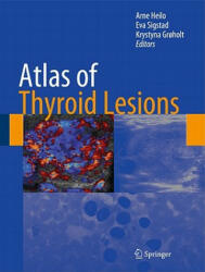 Atlas of Thyroid Lesions - Arne Heilo, Eva Sigstad, Krystyna Groeholt (ISBN: 9781441960092)