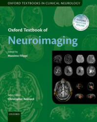 Oxford Textbook of Neuroimaging - Massimo Filippi (ISBN: 9780199664092)
