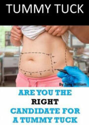 Tummy Tuck: Are You The Right Candidate For A Tummy Tuck - Tony William (ISBN: 9781974097098)