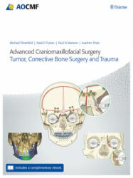 Advanced Craniomaxillofacial Surgery - Paul Manson, Neal D. Futran, Joachim Prein (ISBN: 9783132428393)
