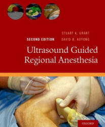 Ultrasound Guided Regional Anesthesia - Stuart A. Grant (ISBN: 9780190231804)