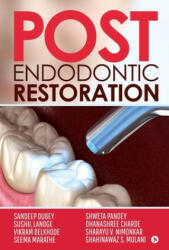 Post Endodontic Restoration - Sushil Landge, Others (ISBN: 9781646507504)