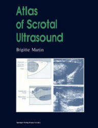 Atlas of Scrotal Ultrasound, 1 - Brigitte Martin, H. Hricak, M. Donon (ISBN: 9783642856839)