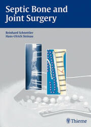 Septic Bone and Joint Surgery - Hans-Ulrich Steinau, Reinhard Schnettler (ISBN: 9783131490315)